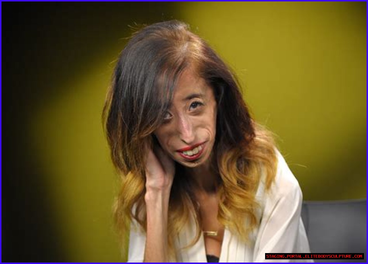 The Surprising Truth About Being Dubbed The Ugliest Person In The World